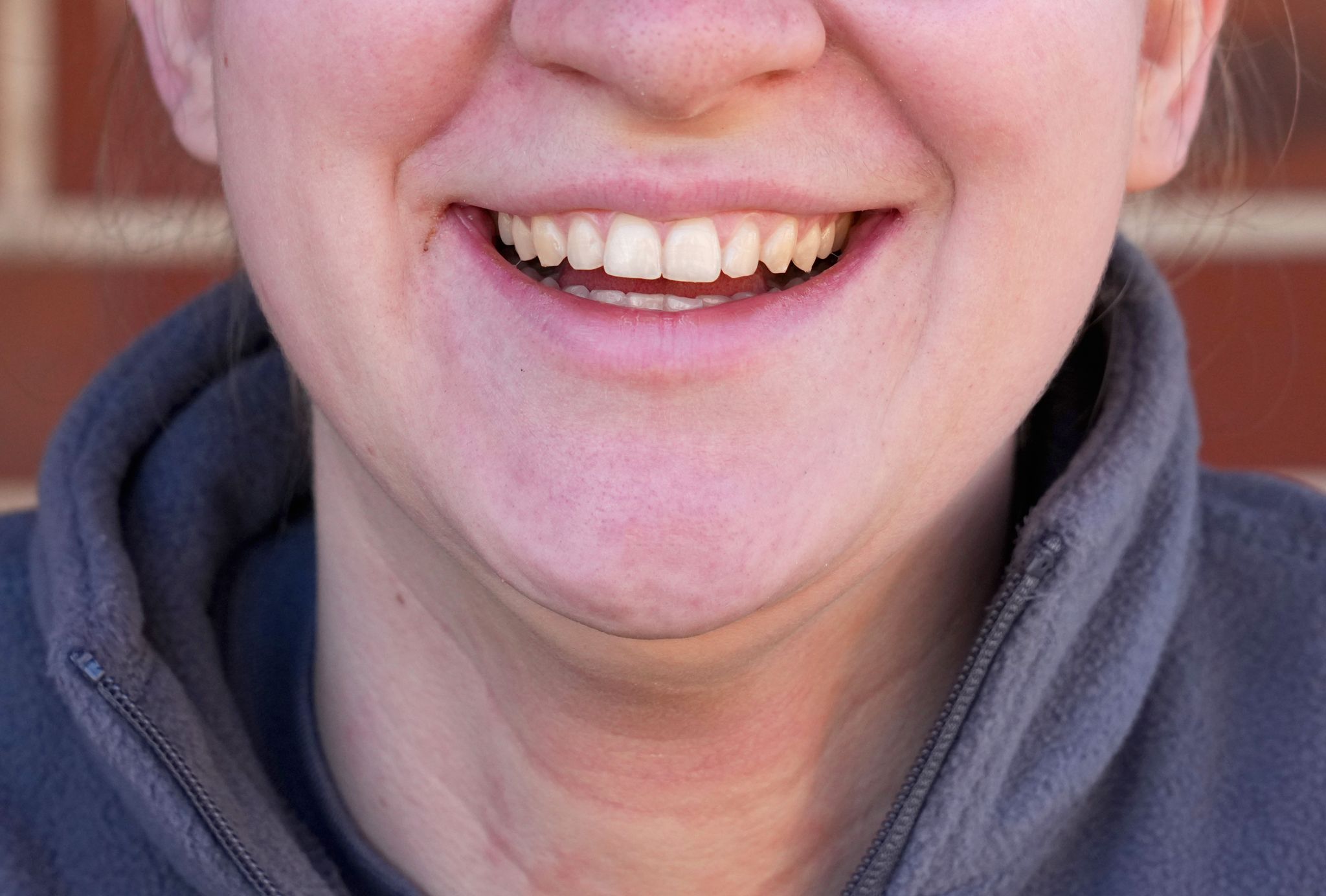 Die Anspannung von Gesichtsmuskeln, wie sie für ein Lächeln üblich ist, macht Menschen ein wenig glücklicher.