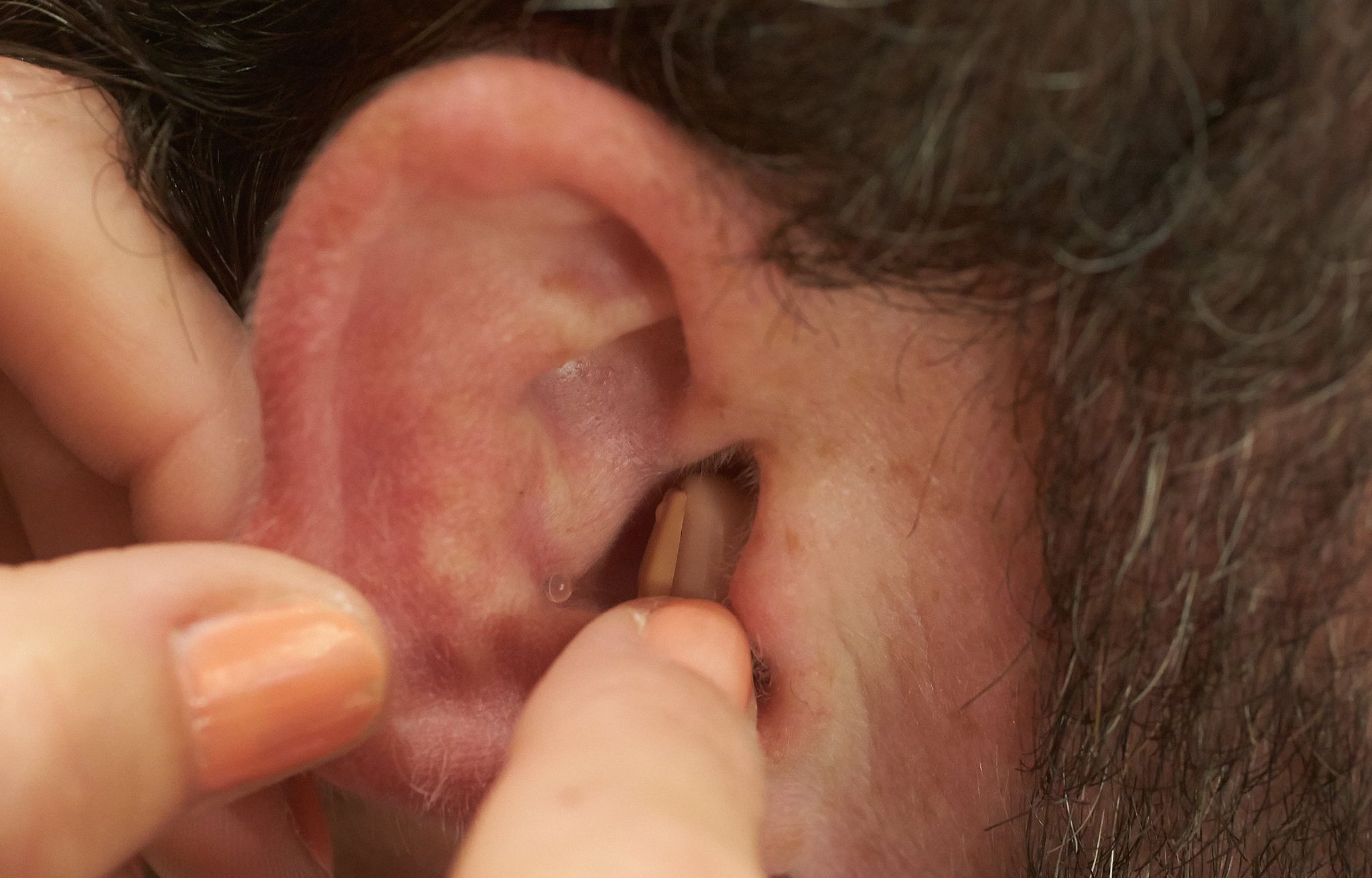 Hörgeräte können bei vielen älteren Menschen eine Demenz vermeiden.