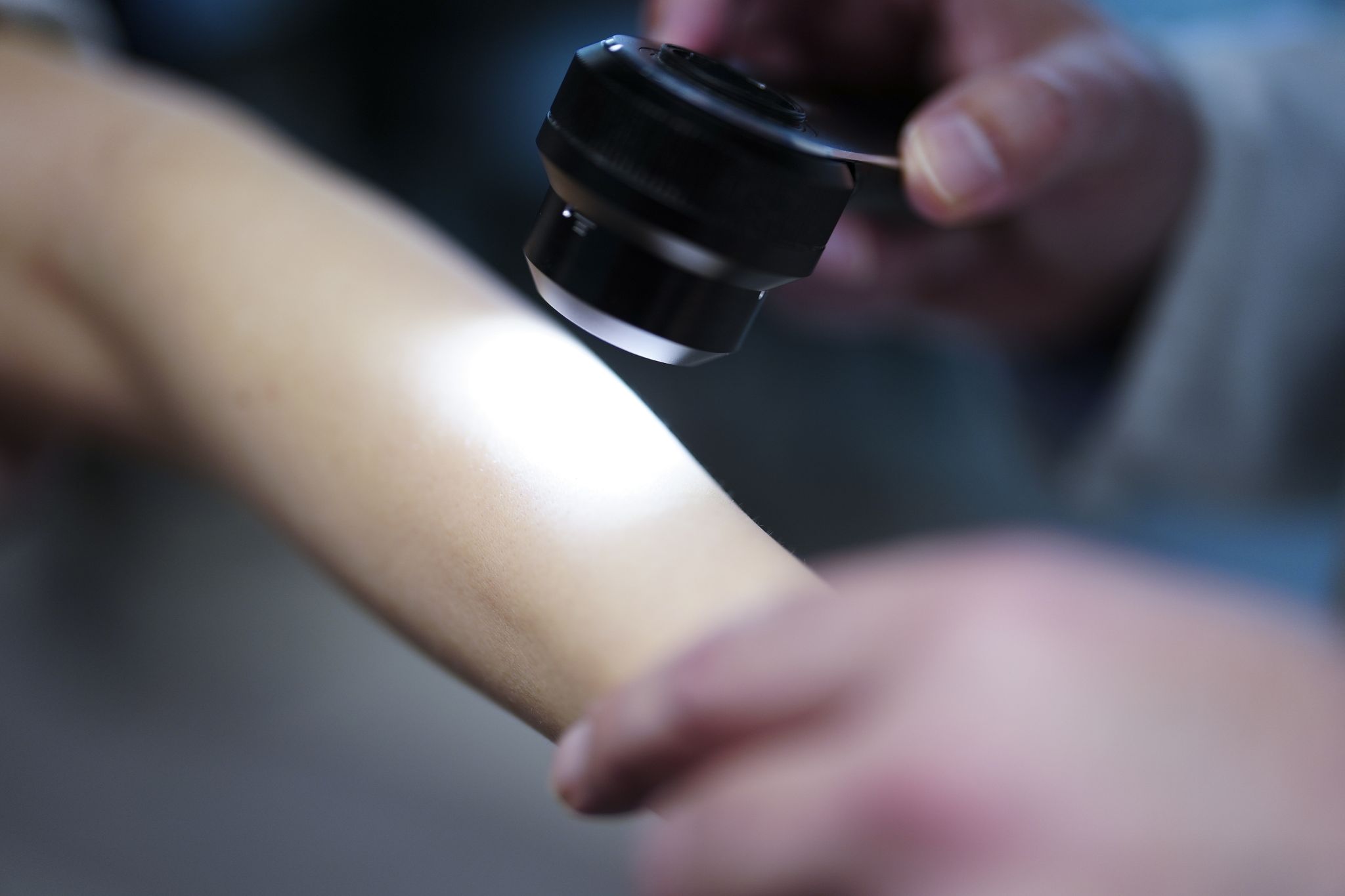 Ein Hautarzt untersucht bei einer Krebsvorsorgeuntersuchung eine Patientin mit einem Auflichtmikroskop.